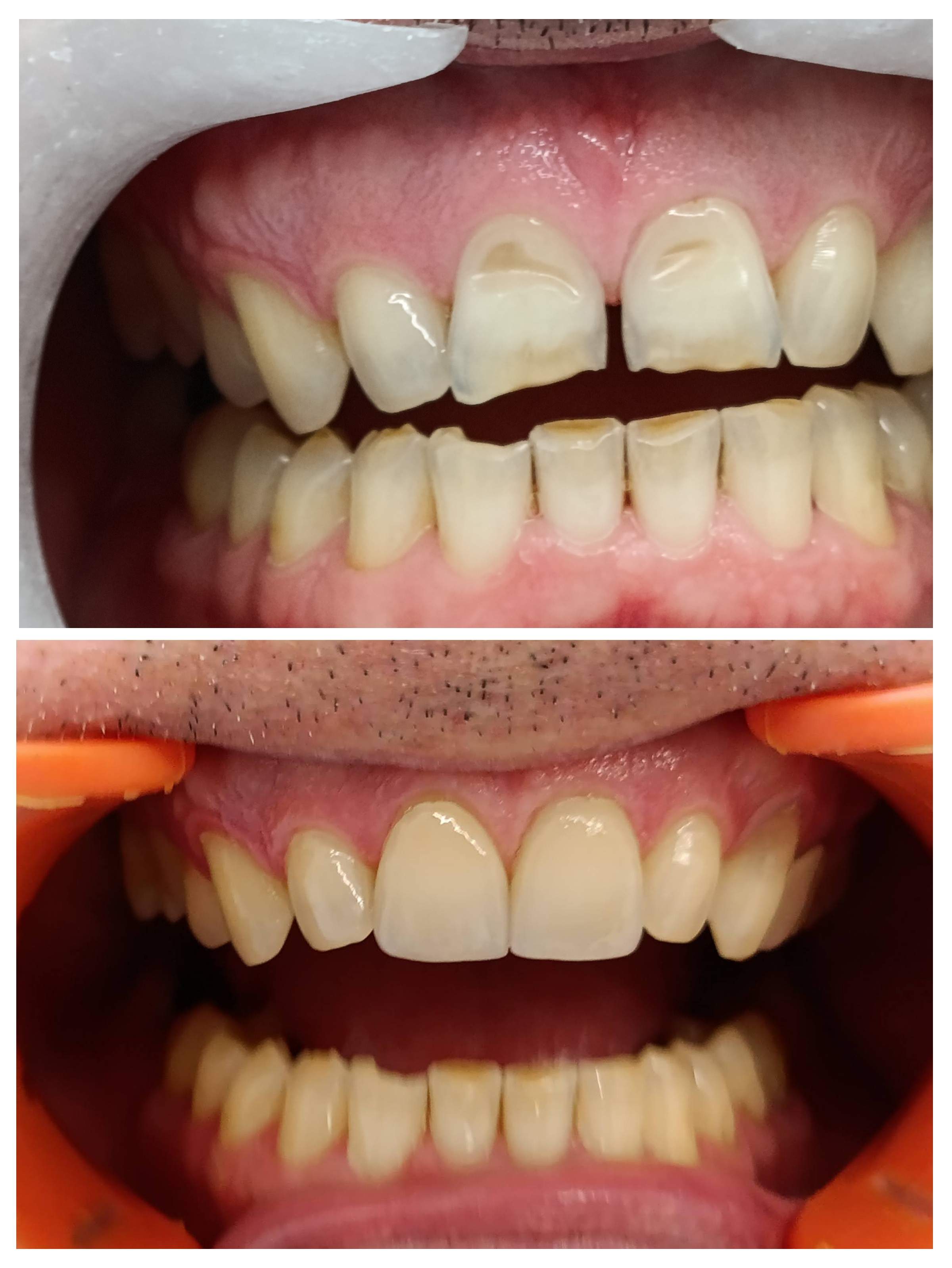 Dentistry | Dr. Mike Frenkin