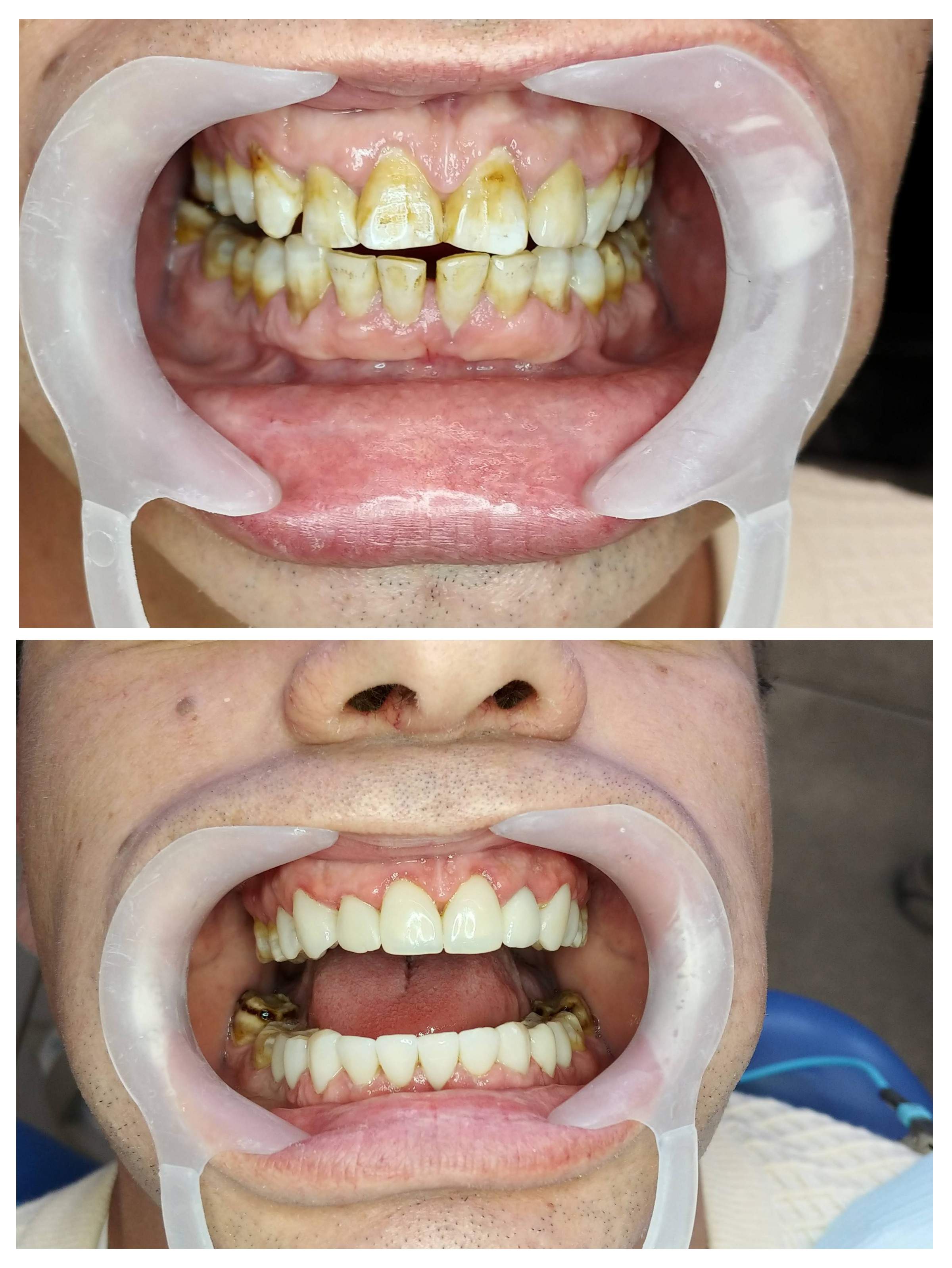 Dentistry | Dr. Mike Frenkin
