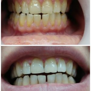 Dentistry | Dr. Mike Frenkin