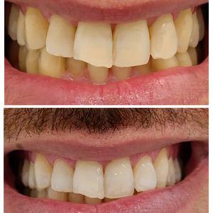 Dentistry | Dr. Mike Frenkin