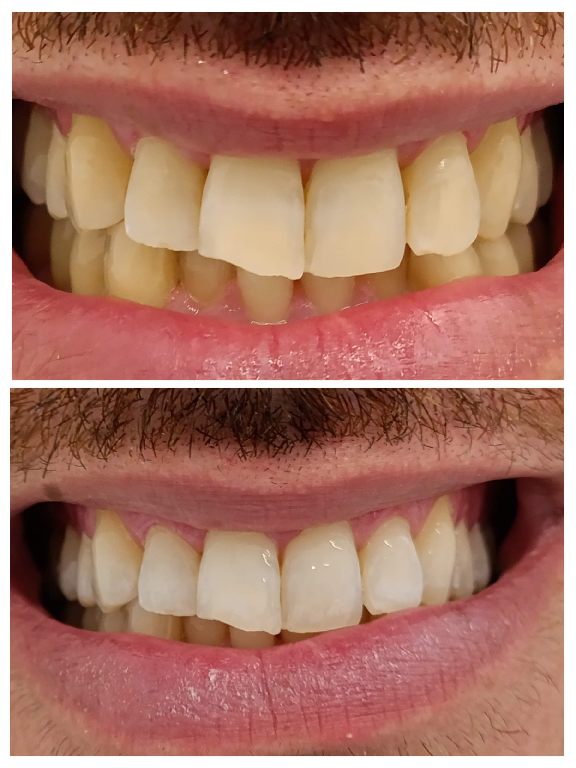 Dentistry | Dr. Mike Frenkin