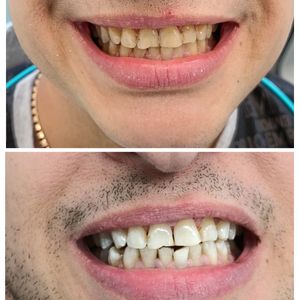 Dentistry | Dr. Mike Frenkin