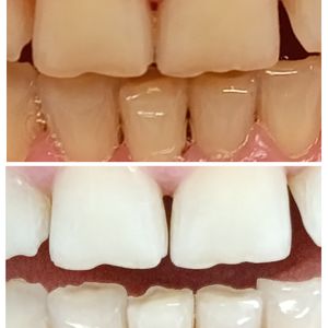 Dentistry | Dr. Mike Frenkin