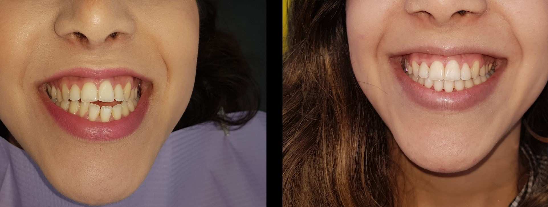 Orthodontics | Dr. Ernesto Shachner