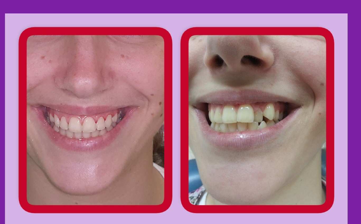 Orthodontics | Dr. Ernesto Shachner