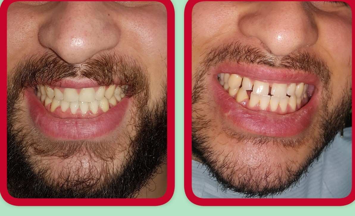 Orthodontics | Dr. Ernesto Shachner