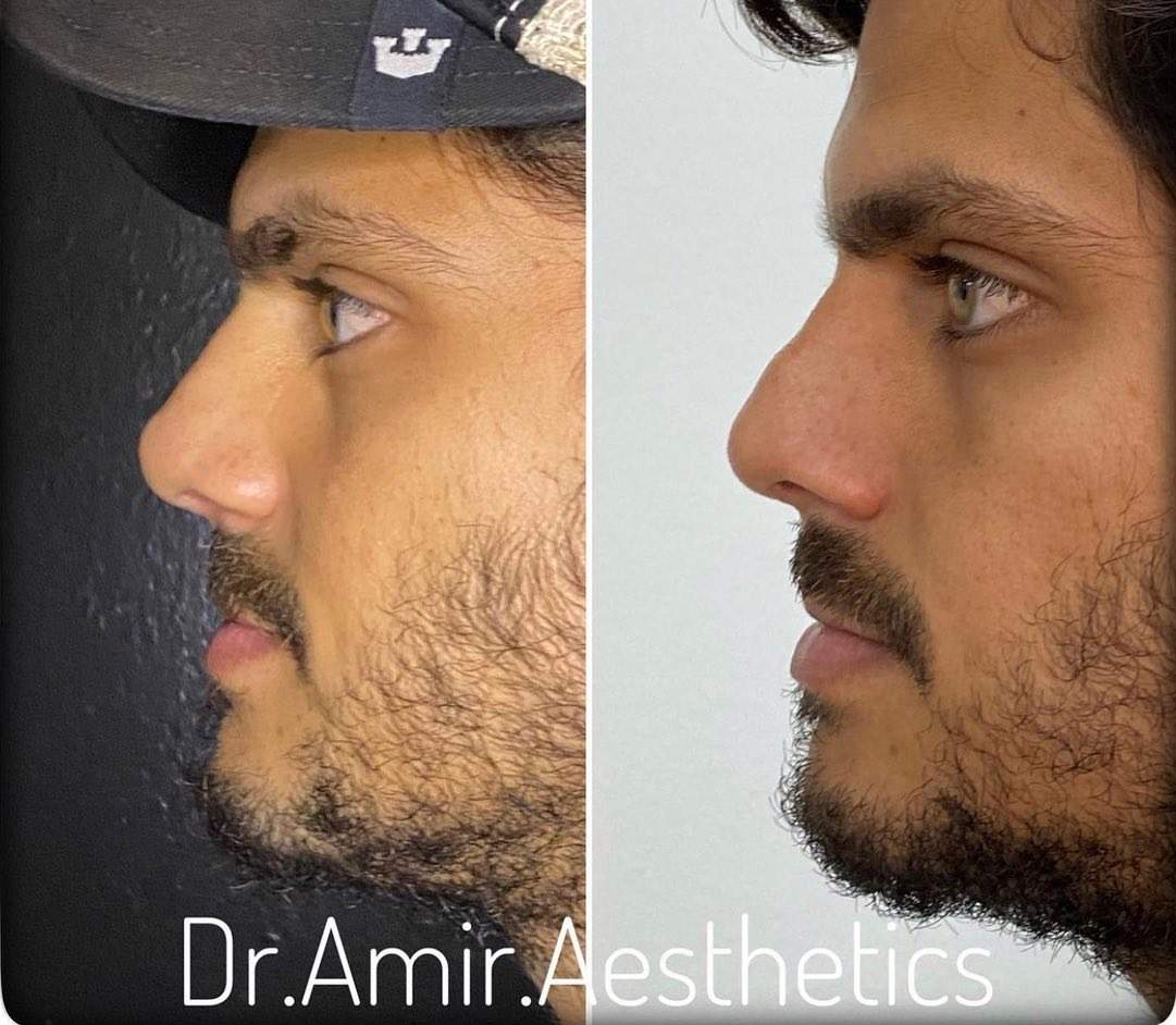 Aesthetic Medicine | Dr. Moshe Amir
