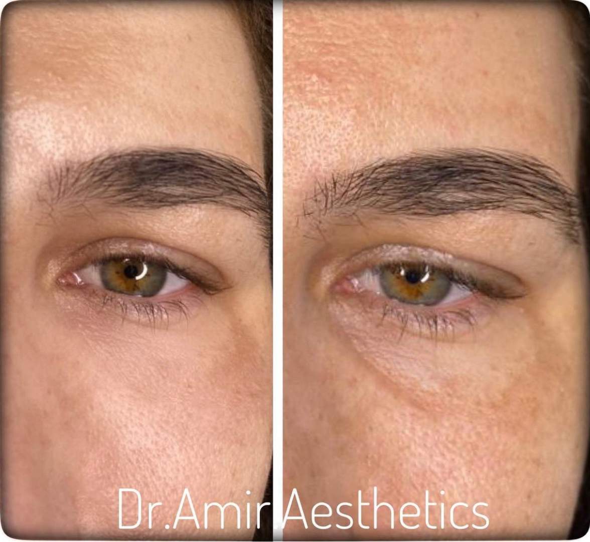 Aesthetic Medicine | Dr. Moshe Amir