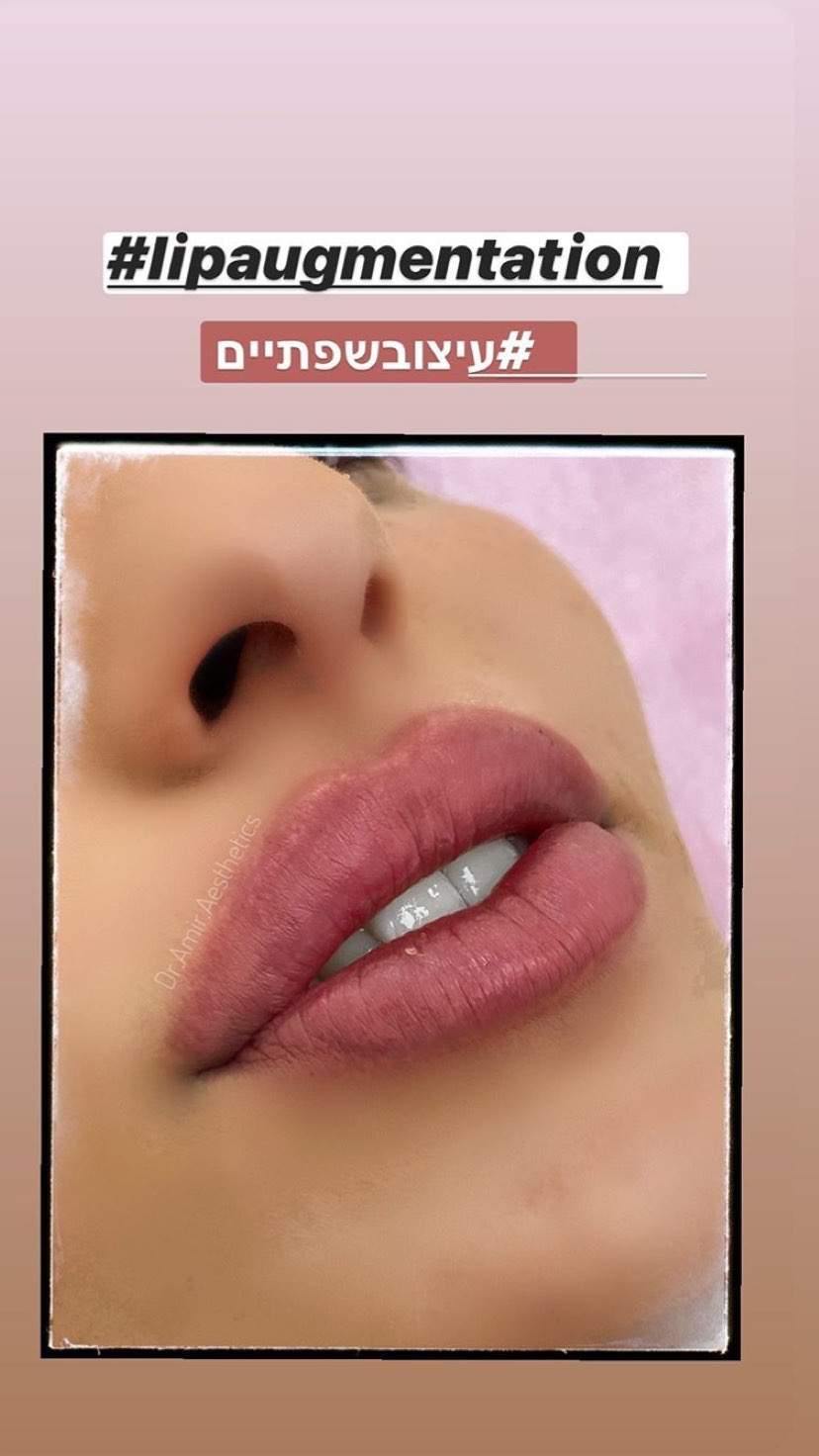 Aesthetic Medicine | Dr. Moshe Amir