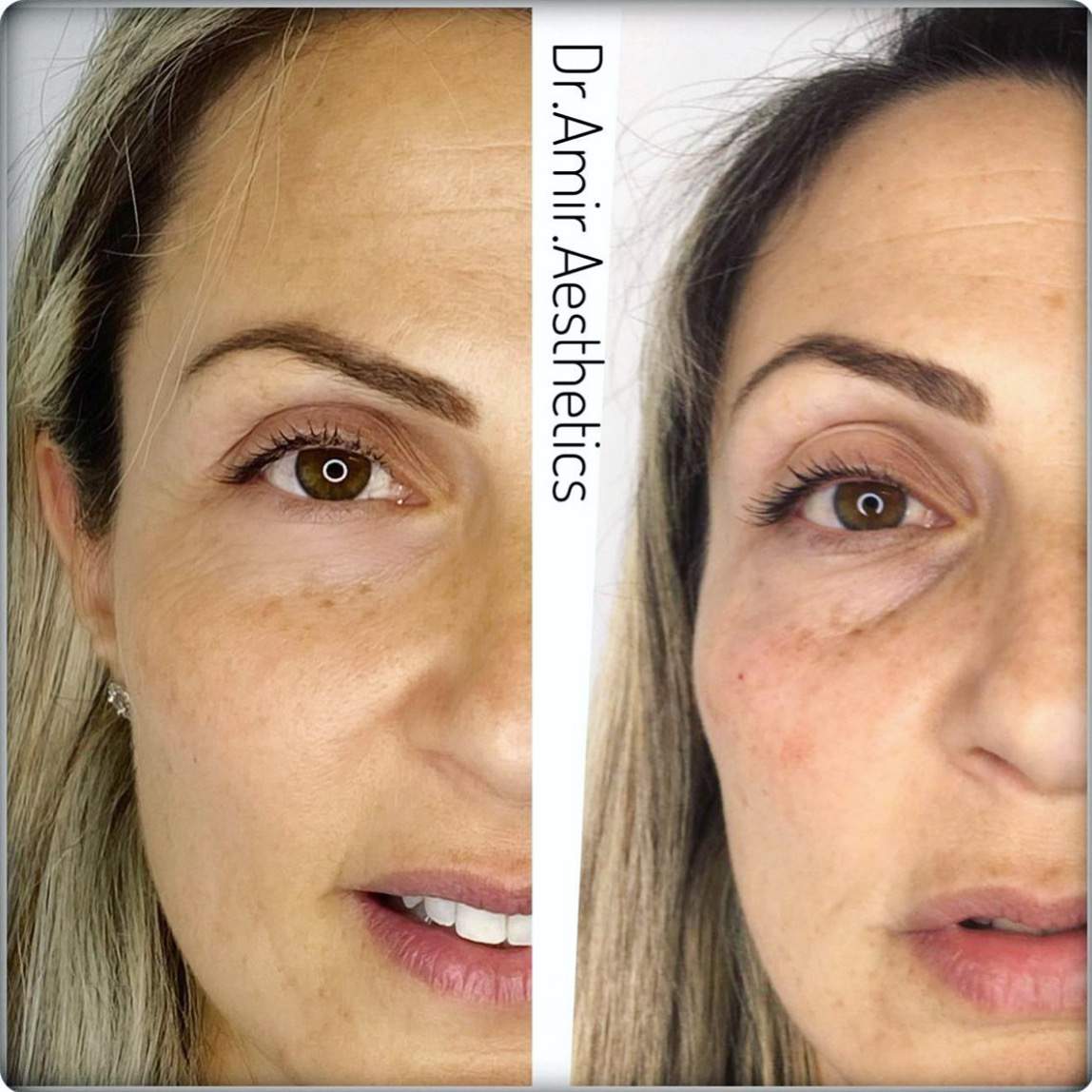 Aesthetic Medicine | Dr. Moshe Amir
