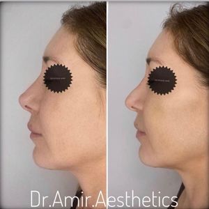 Aesthetic Medicine | Dr. Moshe Amir