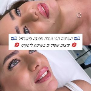 Aesthetic Medicine | Dr. Moshe Amir