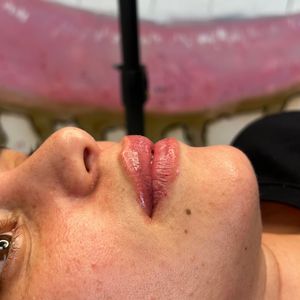 Aesthetic Medicine | Dr. Moshe Amir