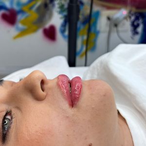 Aesthetic Medicine | Dr. Moshe Amir