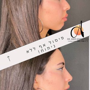 Aesthetic Medicine | Dr. Moshe Amir