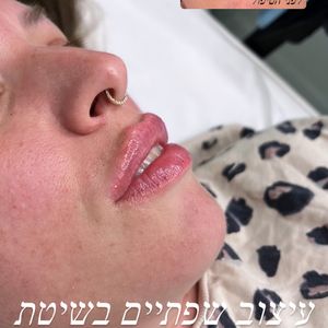 Aesthetic Medicine | Dr. Moshe Amir