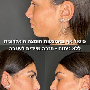 Aesthetic Medicine | Dr. Moshe Amir