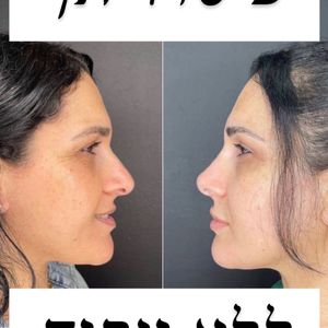 Aesthetic Medicine | Dr. Moshe Amir
