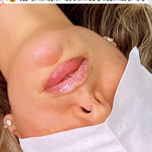 Aesthetic Medicine | Dr. Moshe Amir