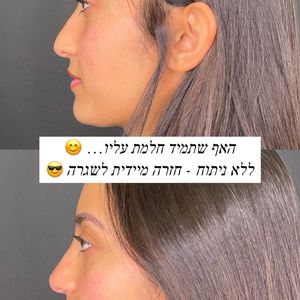 Aesthetic Medicine | Dr. Moshe Amir