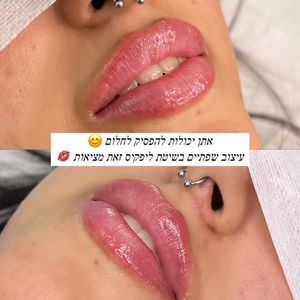 Aesthetic Medicine | Dr. Moshe Amir