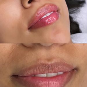 Aesthetic Medicine | Dr. Moshe Amir