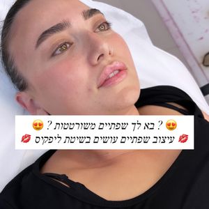 Aesthetic Medicine | Dr. Moshe Amir