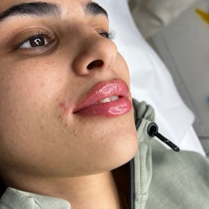Aesthetic Medicine | Dr. Moshe Amir