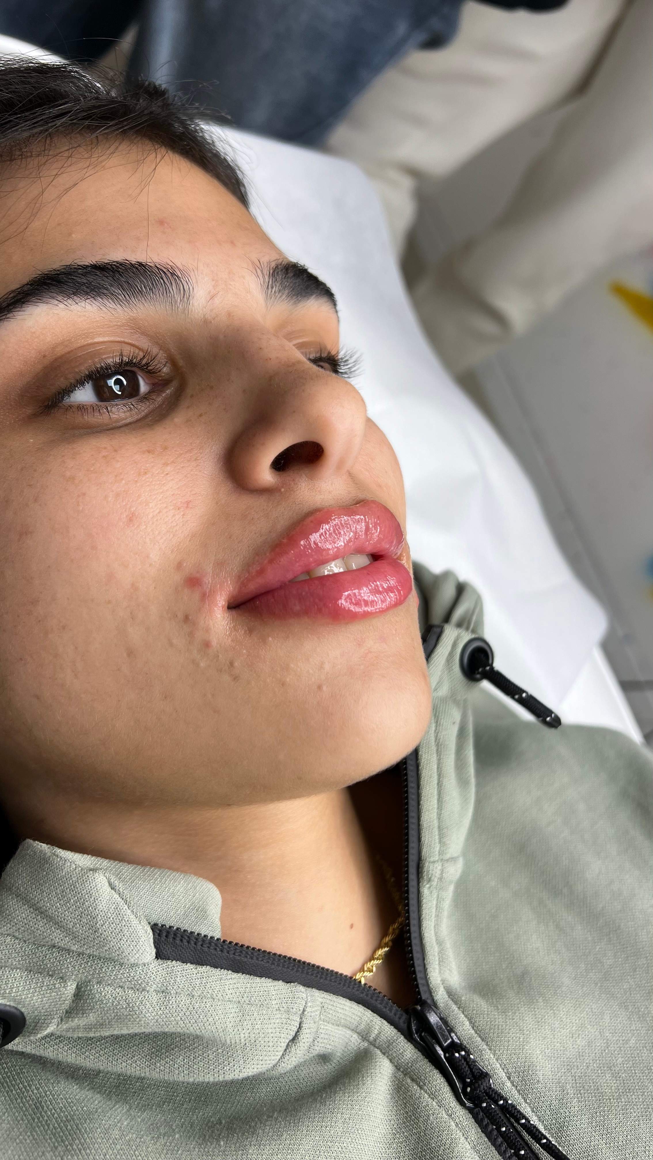 طب التجميل | دكتور موشيه أمير