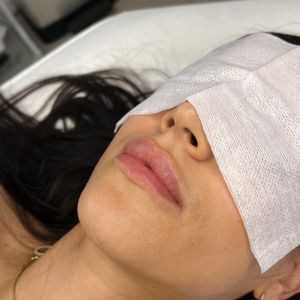 Aesthetic Medicine | Dr. Moshe Amir