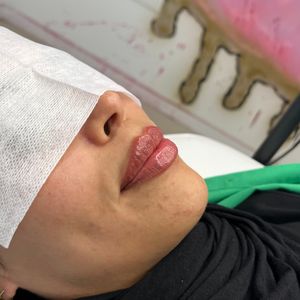Aesthetic Medicine | Dr. Moshe Amir