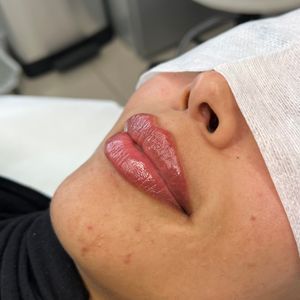 Aesthetic Medicine | Dr. Moshe Amir