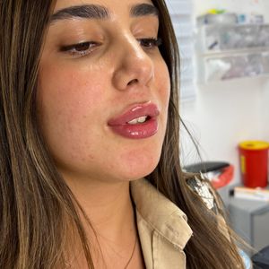 Aesthetic Medicine | Dr. Moshe Amir