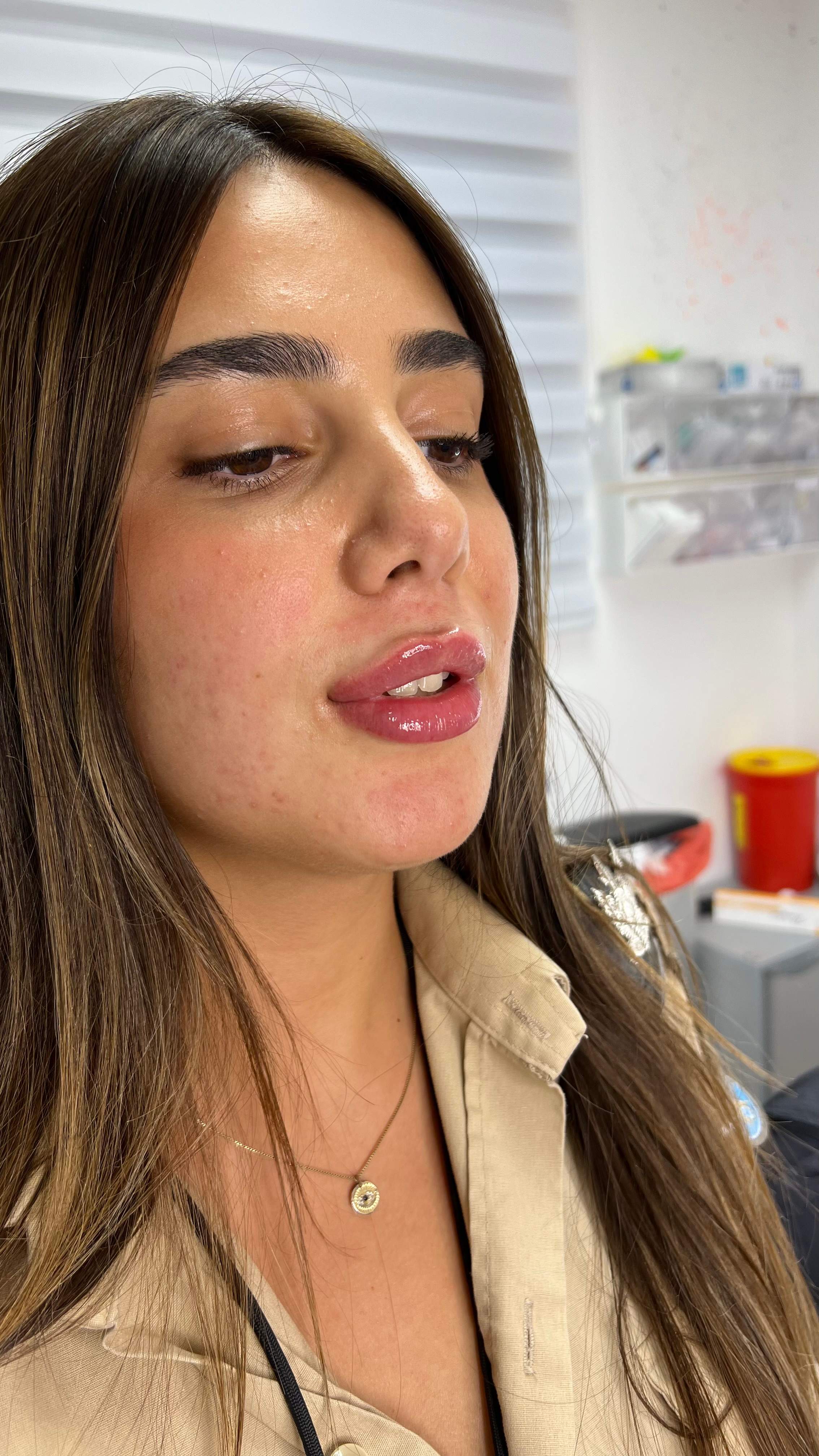 طب التجميل | دكتور موشيه أمير