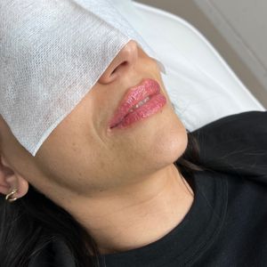 Aesthetic Medicine | Dr. Moshe Amir
