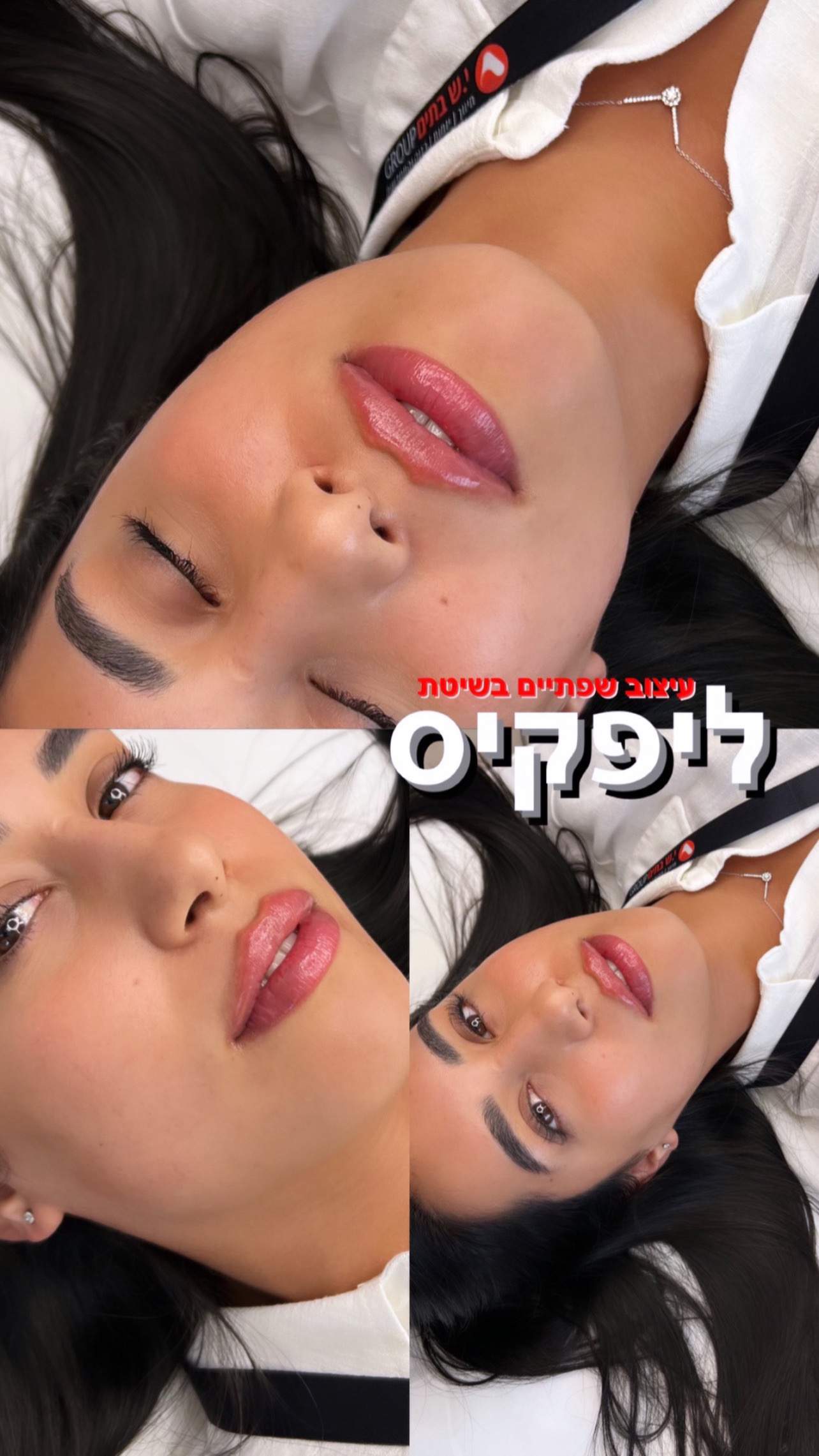 طب التجميل | دكتور موشيه أمير
