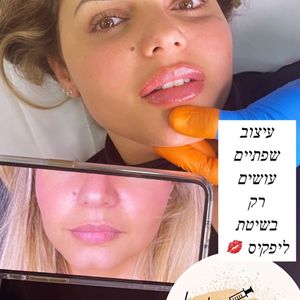Aesthetic Medicine | Dr. Moshe Amir