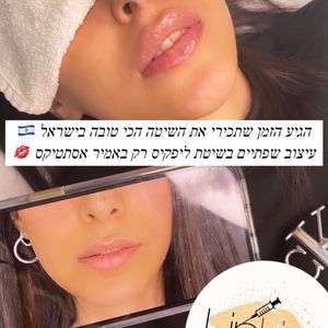 Aesthetic Medicine | Dr. Moshe Amir
