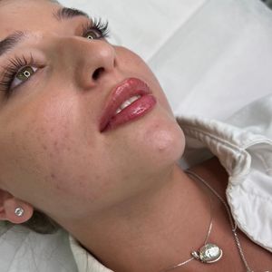 Aesthetic Medicine | Dr. Moshe Amir
