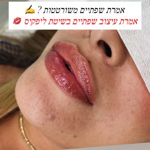 Aesthetic Medicine | Dr. Moshe Amir