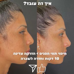 Aesthetic Medicine | Dr. Moshe Amir