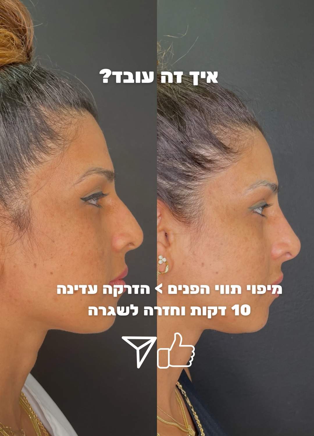 Aesthetic Medicine | Dr. Moshe Amir