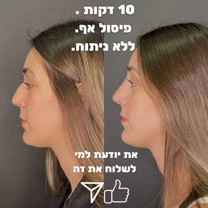 Aesthetic Medicine | Dr. Moshe Amir
