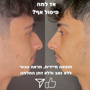 Aesthetic Medicine | Dr. Moshe Amir