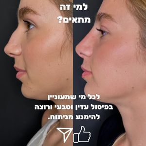 Aesthetic Medicine | Dr. Moshe Amir