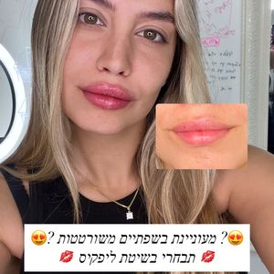 Aesthetic Medicine | Dr. Moshe Amir