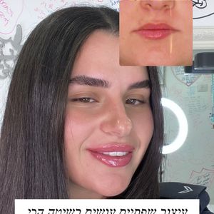 Aesthetic Medicine | Dr. Moshe Amir