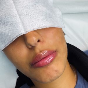 Aesthetic Medicine | Dr. Moshe Amir