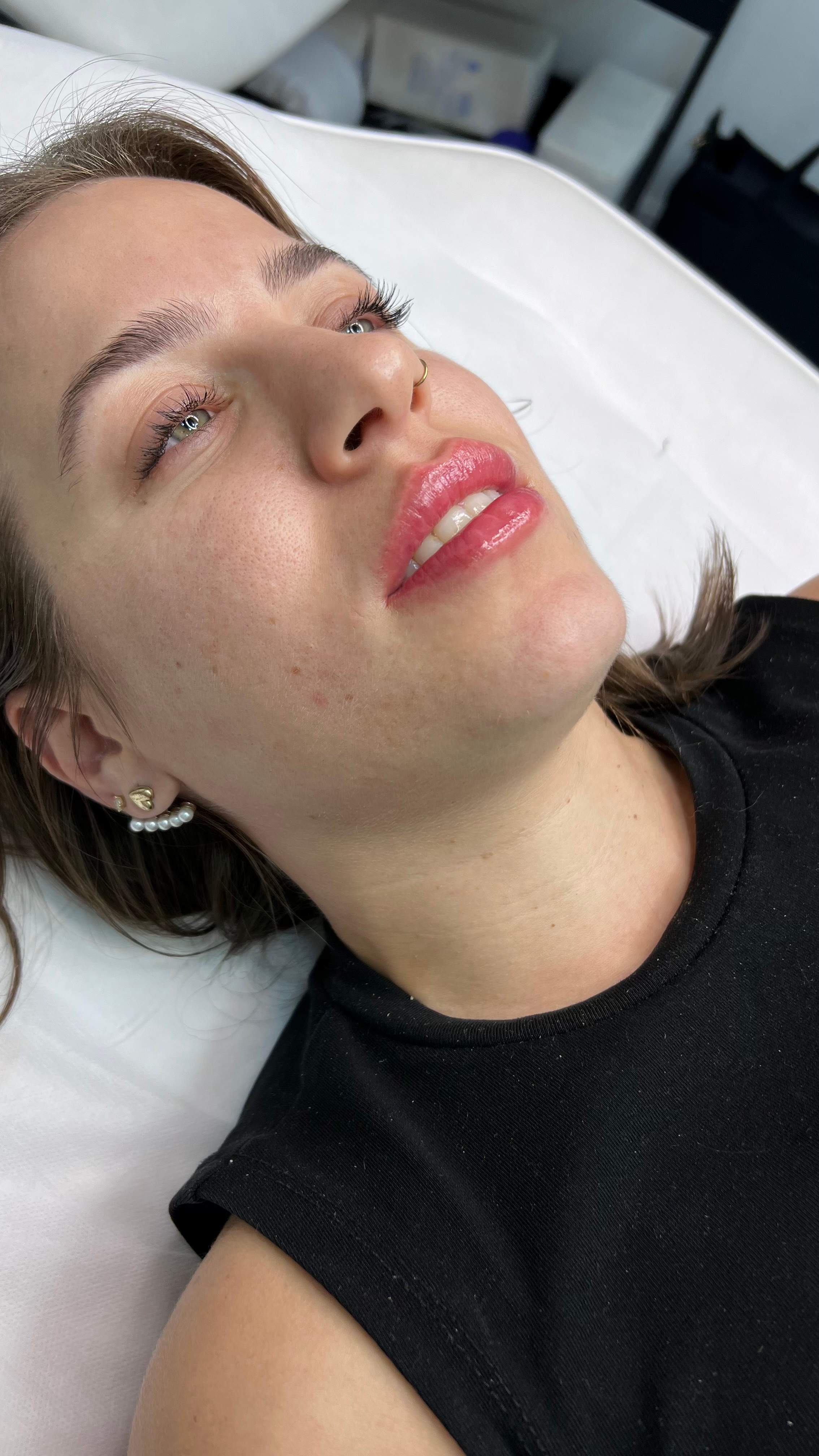 طب التجميل | دكتور موشيه أمير