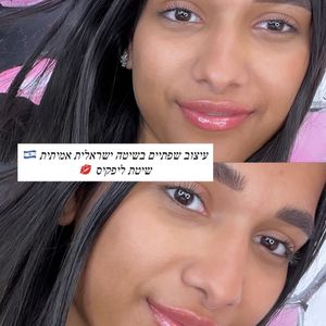 Aesthetic Medicine | Dr. Moshe Amir